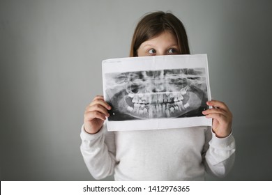 girl with x-ray snapshot of teeth, x-ray of calf's teeth and permanent teeth in the hands of a child. Funny children's emotions and children's health, dentistry