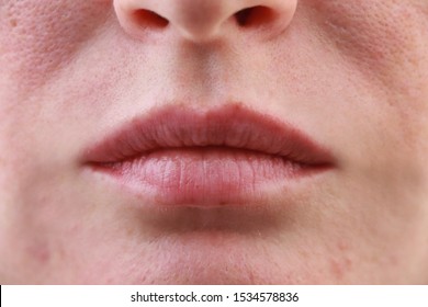 Open Pores Images, Stock Photos & Vectors | Shutterstock