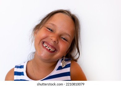 Glad Shiny Smiling Little Blonde Girl With Baby Temporary Milk Crooked Teeth On White Background. Orthodontic Practice With Thin Enamel. Dental Care And Dentist Appointment. Healthcare And Hygiene