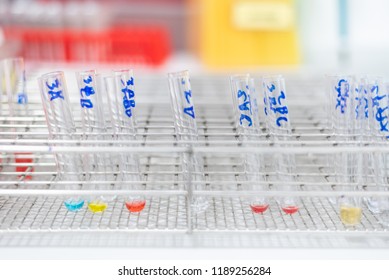 Glass Test Tubes And Reagent In The Metal Rack For Cross Matching Blood For Emergency Patient Case At Blood Bank Unit Laboratory. 