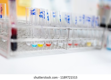 Glass Test Tubes And Reagent In The Metal Rack For Cross Matching Blood For Emergency Patient Case At Blood Bank Unit Laboratory. 