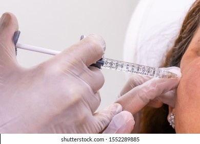 Gloved Doctor Hand Injecting A Vial Of Hyaluronic Acid (HA) Based Dermal Filler Into Patient For A Non-surgical Cheek And Face Lift.