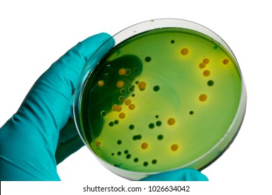 Gloved hand holding a Petri dish Bacteria culture growth on agar medium in Microbiology room at Laboratory. Green and yellow bacteria on a petri dish in the hand of a scientist on a white background.