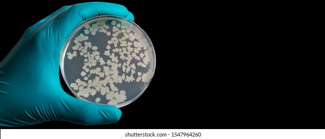 Gloved Hand Holding A Petri Dish Bacteria Culture Growth On Agar Medium In Microbiology Room At Laboratory. Yellow Bacteria On A Petri Dish In The Hand Of A Scientist On A Black Background.