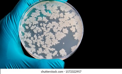 Gloved Hand Holding Petri Dish Bacteria Stock Photo 1572322957 ...