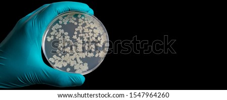 Gloved hand holding a Petri dish Bacteria culture growth on agar medium in Microbiology room at Laboratory. Yellow bacteria on a petri dish in the hand of a scientist on a black background.