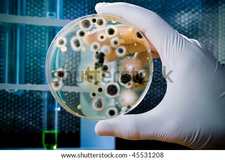  Gloved hand holding a Petri dish