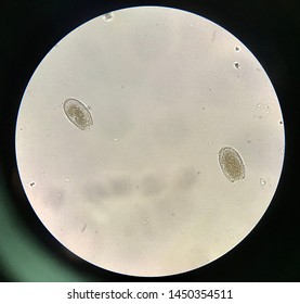 Gnathostoma Spinigerum Eggs Stool Examination Stock Photo 1450354511 ...