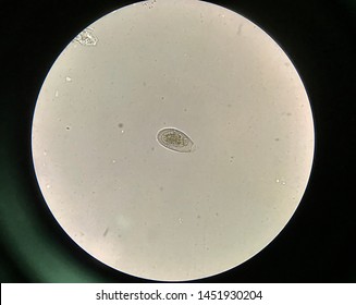 Gnathostoma Spinigerum Eggs Stool Examination Stock Photo 1451930204 ...