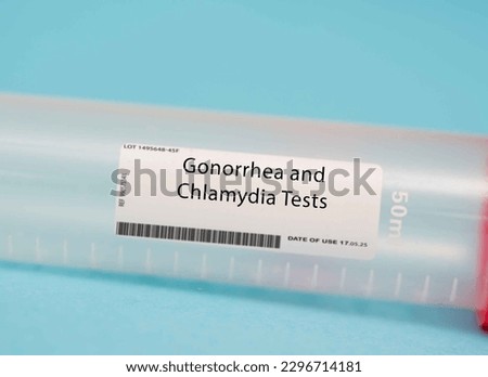 Gonorrhea and Chlamydia tests. These tests screen for two common sexually transmitted infections (STIs), gonorrhea and chlamydia. The tests involve taking a swab of the cervix s.