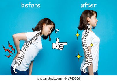 Good Posture And Bad Posture, Woman's Body Silhouette And Backbone, Chiropractic Before After Concept