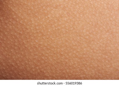 Goose bumps on human skin closeup. Tecture of skin with goose bumps