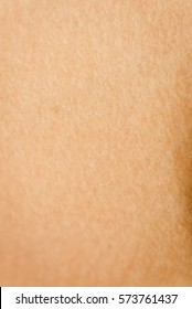 Goose Bumps On Human Skin Closeup. Background And Texture Of Skin With Goose Bumps.  Which Including Of Dark And White Human Skin.