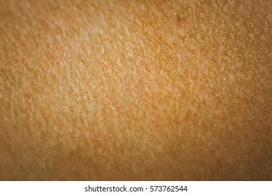 Goose Bumps On Human Skin Closeup Stock Photo 573762544 | Shutterstock