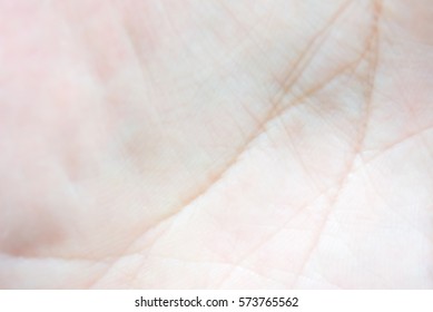 Goose Bumps On Human Skin Closeup. Background And Texture Of Skin With Goose Bumps.  Which Including Of Dark And White Human Skin.