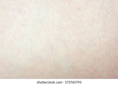 Goose Bumps On Human Skin Closeup Stock Photo (Edit Now) 573764635