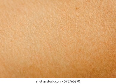 Goose Bumps On Human Skin Closeup. Background And Texture Of Skin With Goose Bumps.  Which Including Of Dark And White Human Skin.