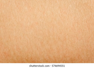 Goose Bumps On Human Skin Closeup. Background And Texture Of Skin With Goose Bumps.  Which Including Of Dark And White Human Skin.