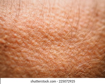 Goose Bumps On Skin