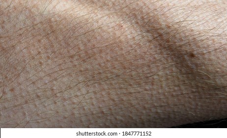 Goosebumps Appearing On Male Forearm Skin Fast Motion Close Up