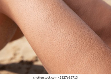 Goosebumps on the legs of a young woman sitting on the beach. Contrasting air and sun baths. Close-up.
