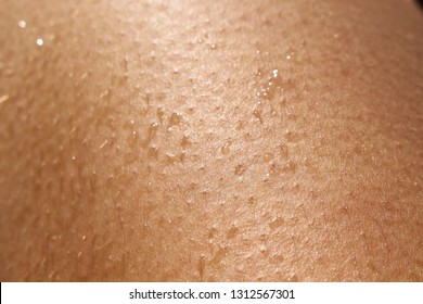 Goosebumps On Skin Moisture Stock Photo Shutterstock