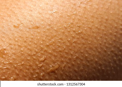 Goosebumps On The Skin From Moisture.