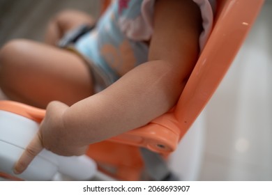 Goosebumps Skin Of Baby Infant Arm.