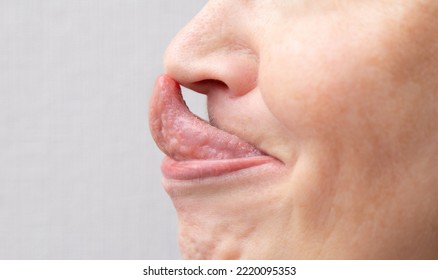 The Gorlin Sign Is A Medical Term That Indicates The Ability To Touch The Tip Of The Nose With The Tongue. Might Be The Sign Of Ehlers–Danlos Syndrome.