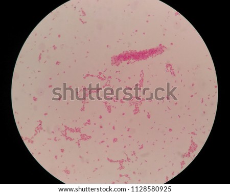 Gram negative bacilli bacteria.