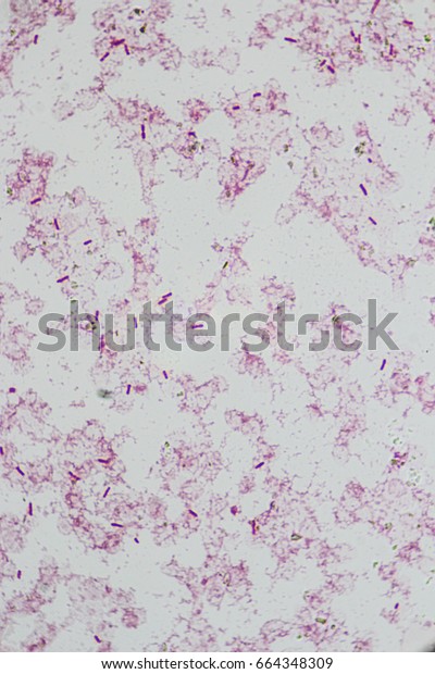 Gram Negative Bacilli Bacteria Stock Photo 664348309 | Shutterstock