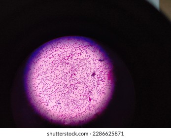 Gram negative bacilli under light microscope ( 40X)