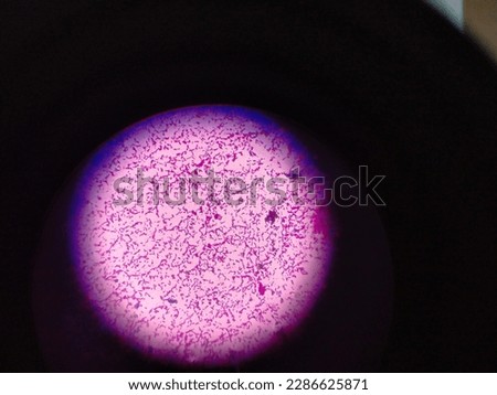 Gram negative bacilli under light microscope ( 40X)