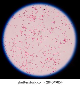 Gram Negative Bacilli,Gram Stain.