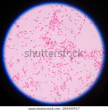 Gram Negative Bacilli Gram Stain Stock Photo (Edit Now) 284349917 ...