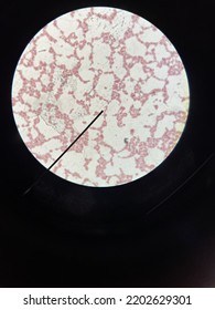 Gram Negative Bacteria Under The Microscope