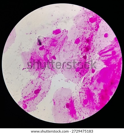 Gram negative Diplococci under microscope.
