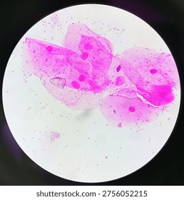 Gram negative diplococcus under microscope.