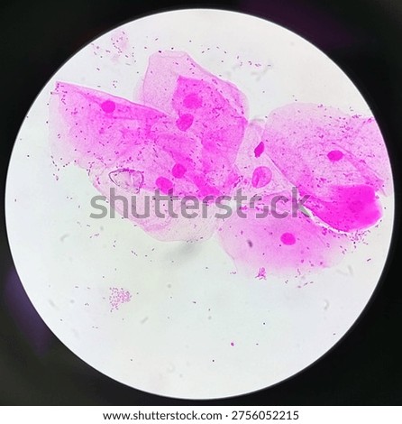 Gram negative diplococcus under microscope.