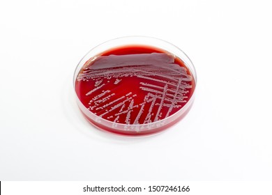 Gram negative rod or bacilli on the blood agar or red agar. Isolated colony or colonies with hemolysis 