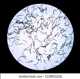 Gram Positive Bacteria 1000x Under Microscope Stock Photo 1129815218 ...