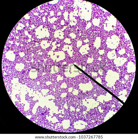 gram positive in cluster