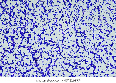 Gram Positive Cocci Bacteria Microbiology Stock Photo 474116977 ...