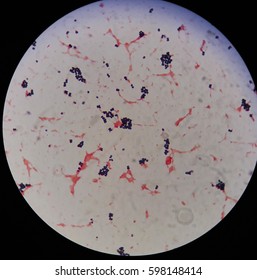 cocci bacteria under microscope