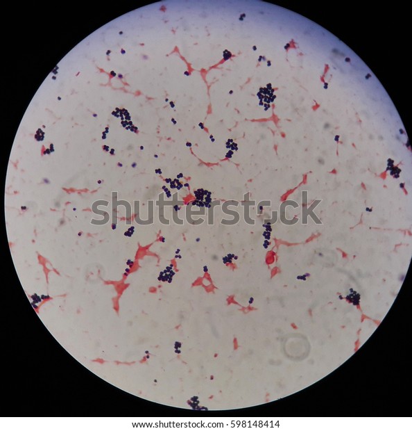 Gram Positive Cocci Bacteria Under 100x Stock Photo (Edit Now) 598148414