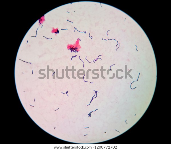 Gram Positive Cocci Chains Streptococcus Species Stock Photo (Edit Now ...