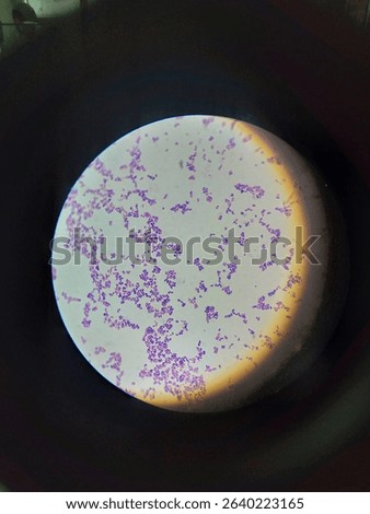 Gram positive Cocci in clusters 