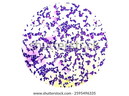 Gram positive Staphylococcus appears in cluster form under the microscope. Staphylococcus aureus