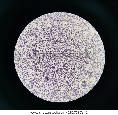 Gram positive Staphylococcus appears in cluster form under the microscope. Staphylococcus aureus