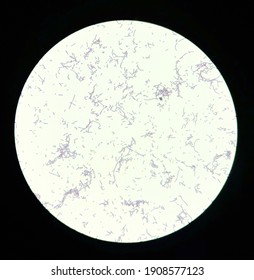 bacillus cereus gram stain